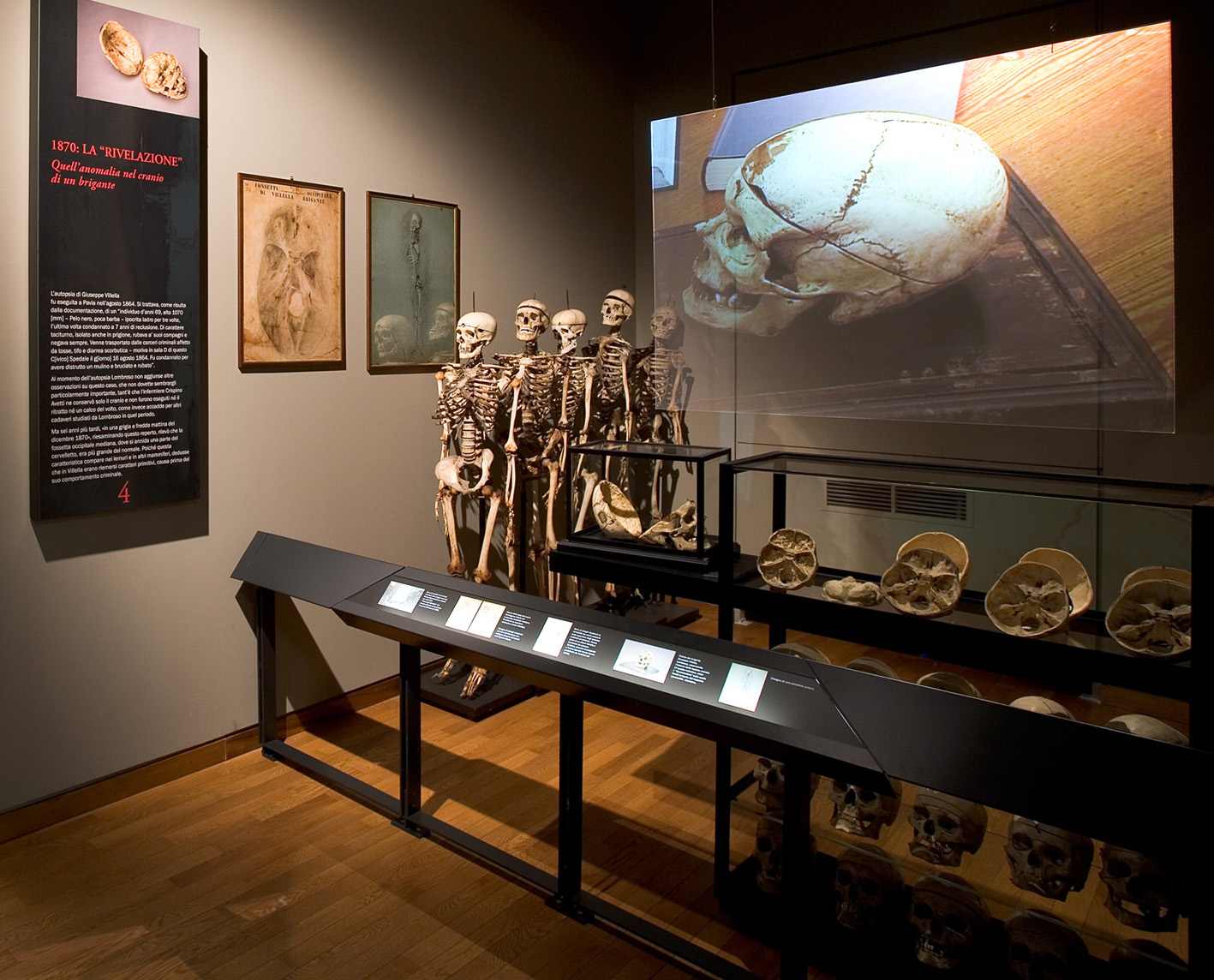 museo di antropologia criminale cesare lombroso torino